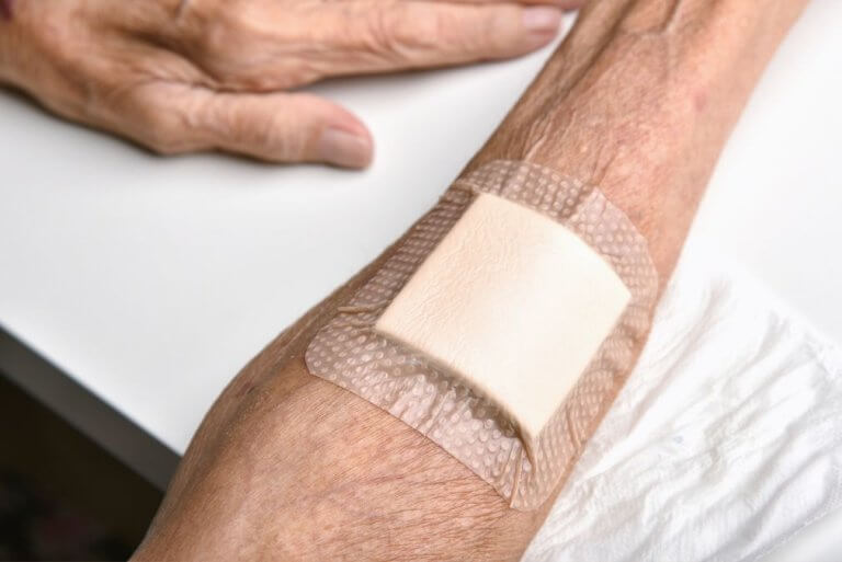 Complicațiile escarelor de decubit: De ce prevenția este mai ieftină decât tratamentul Complicațiile escarelor de decubit: De ce prevenția este mai ieftină decât tratamentul
