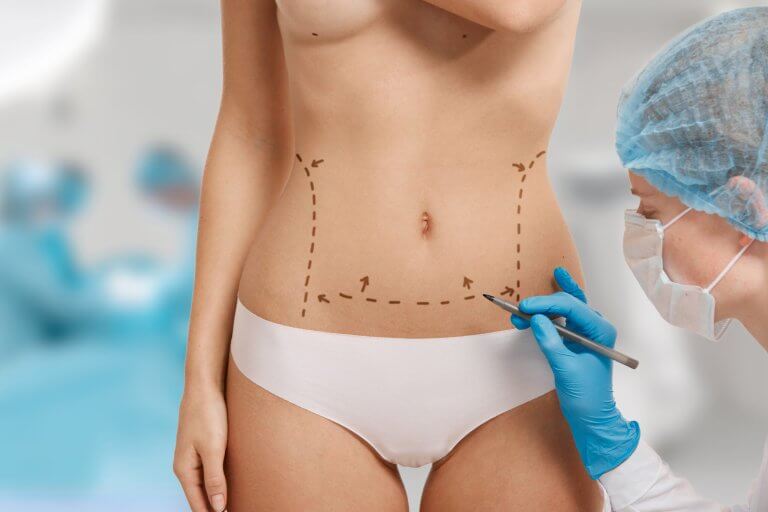 Corpul tău, regulile tale: Ghidul tău despre liposucție și abdominoplastie Corpul tău, regulile tale: Ghidul tău despre liposucție și abdominoplastie